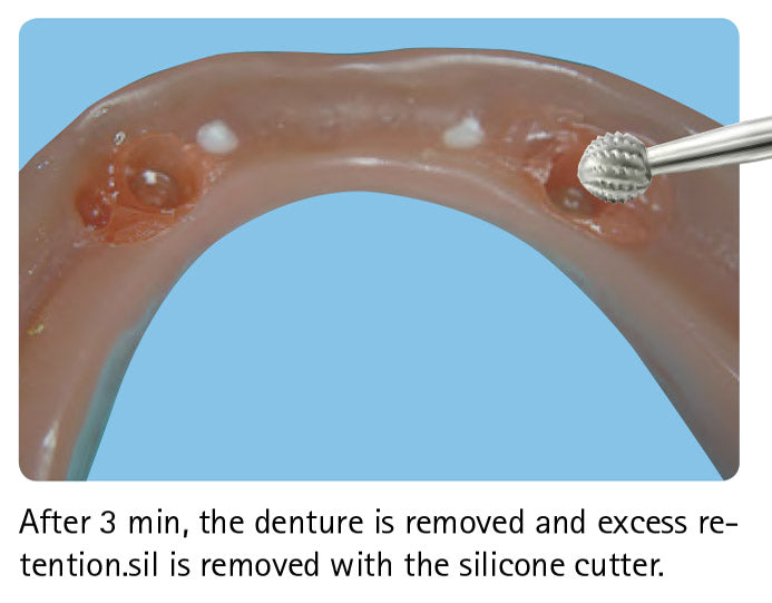 Bredent Retention.Sil, Set Impulsedent Australia