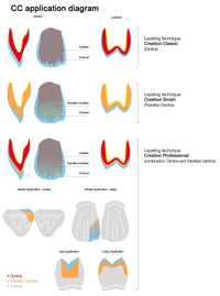 Creation TD / Transition Dentine Basic porcelains, Kit