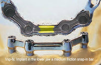 Bredent vario-soft-bar-pattern titanium bar vsp-fs and vsp-gs, 1 pc