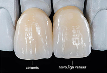 Bredent novo.lign Veneers Teeth – Lower anterior D38, 6er