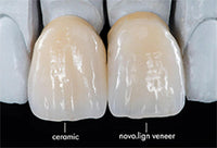 Bredent novo.lign Veneers Teeth – Upper anterior C43, 6er