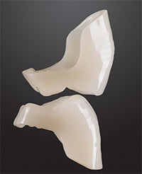 Bredent novo.lign Veneers Teeth – Upper posterior L2, 3 left and 3 right