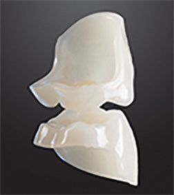 Bredent novo.lign Veneers Teeth – Upper posterior G4, Q2 left upper