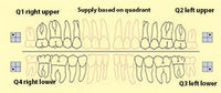 Bredent novo.lign Veneers Teeth – Lower posterior G3, Q4 right lower