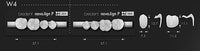 Bredent novo.lign Veneers Teeth – Lower posterior W4, Q4 right lower