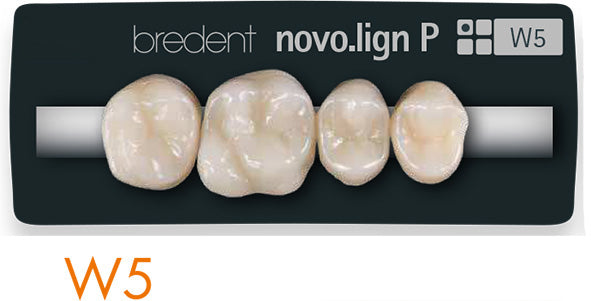 Bredent novo.lign Veneers Teeth – Upper posterior W5, Q1 right upper