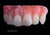 Creation VC / Composite Gingiva Opaque (O-G), 3.75g