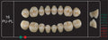 Creation Creopal Full Teeth Mould PU16, 8er